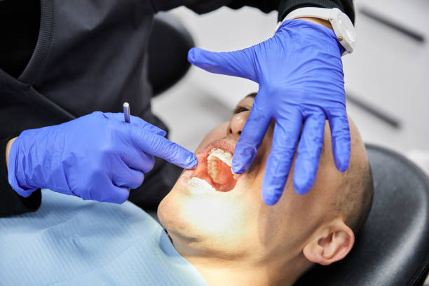 Dentist for Dental Trauma in SD